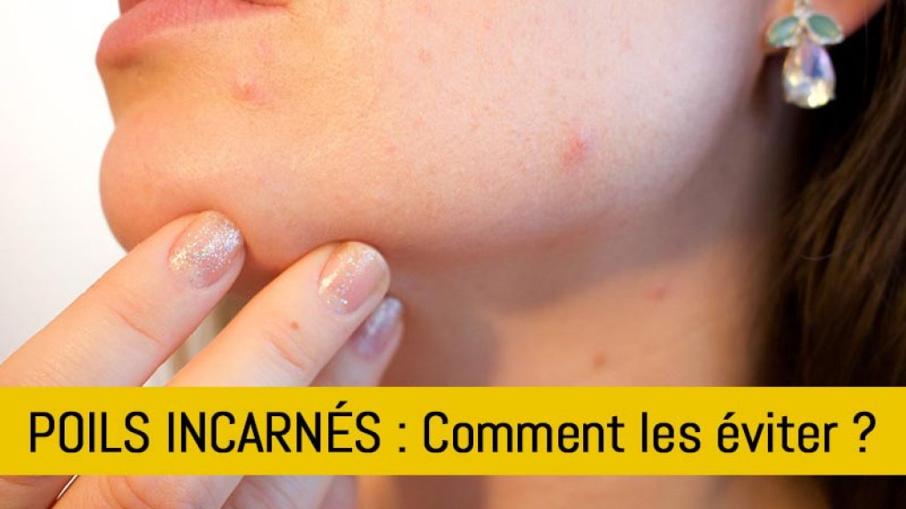 Comment se débarrasser des poils incarnés
