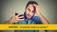 Tout ce que vous devez savoir sur le Minoxidil